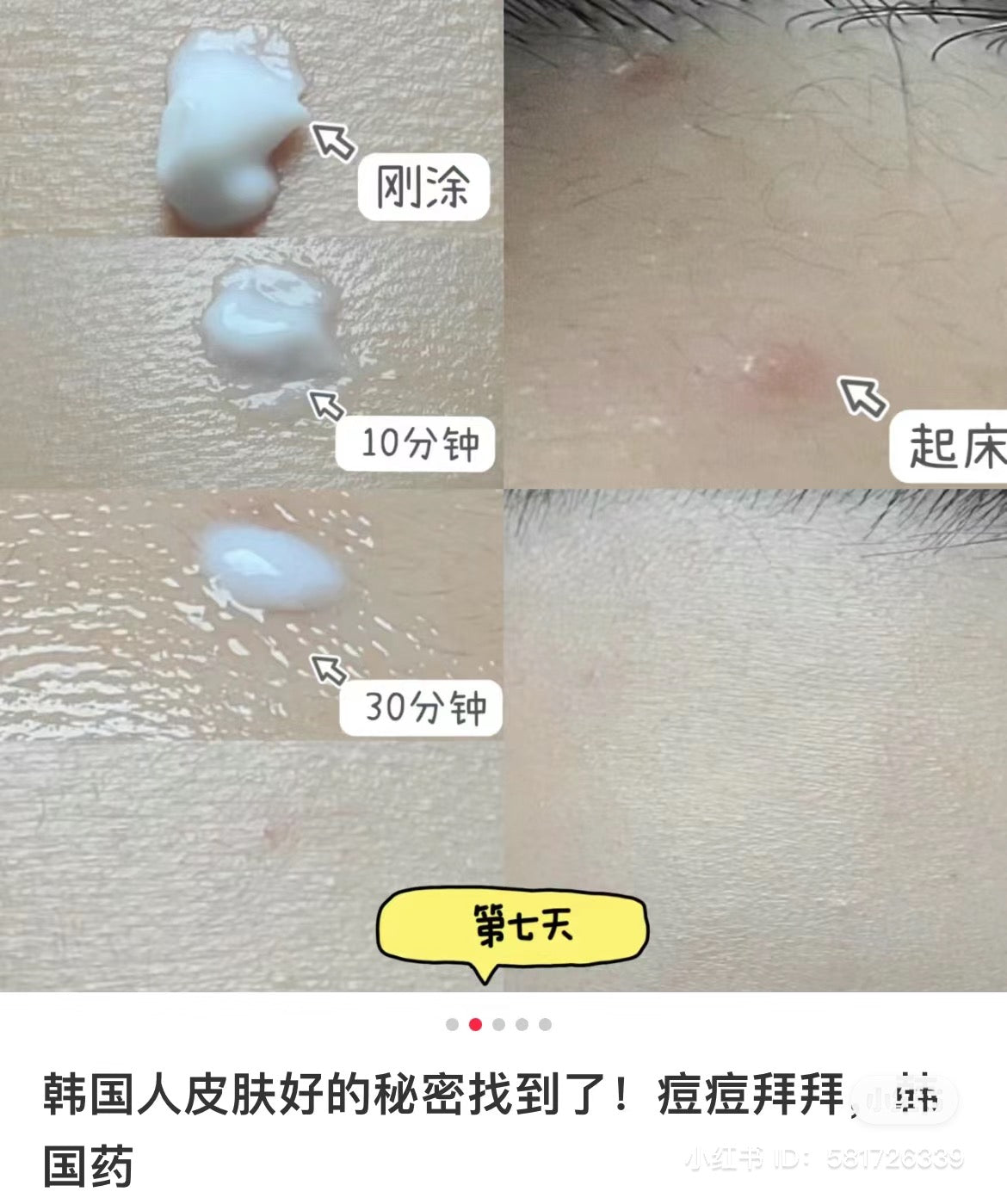 Noscarna ่ขช็่
