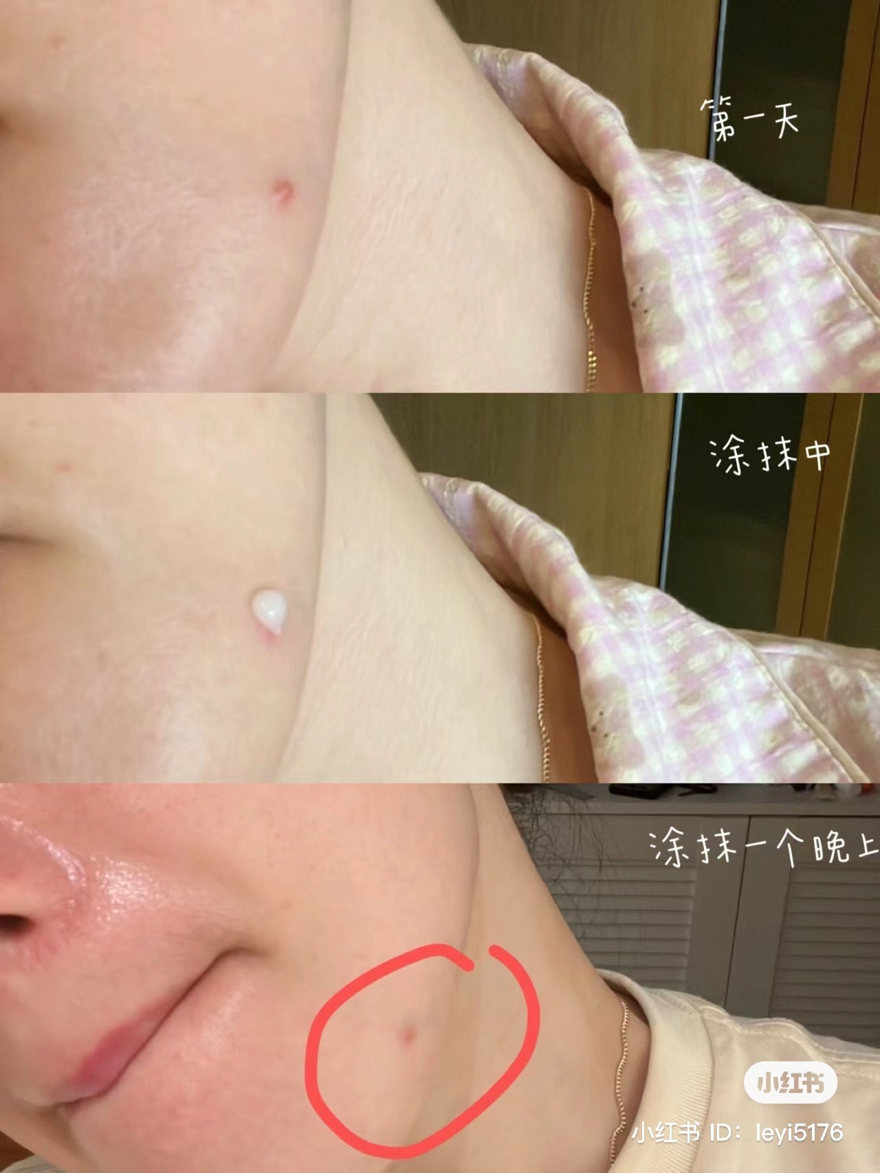 Noscarna ่ขช็่