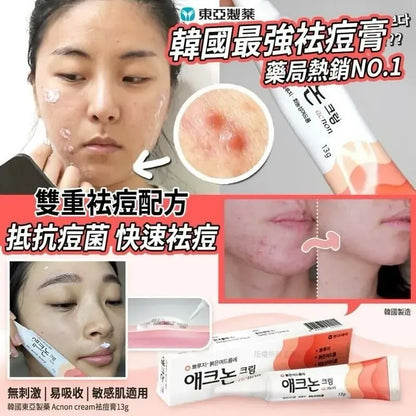 Acnon 暗瘡膏