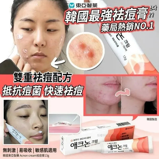 Acnon 暗瘡膏